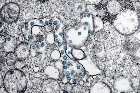 Microbiome et hydratation : Le duo gagnant pour votre santé intestinale