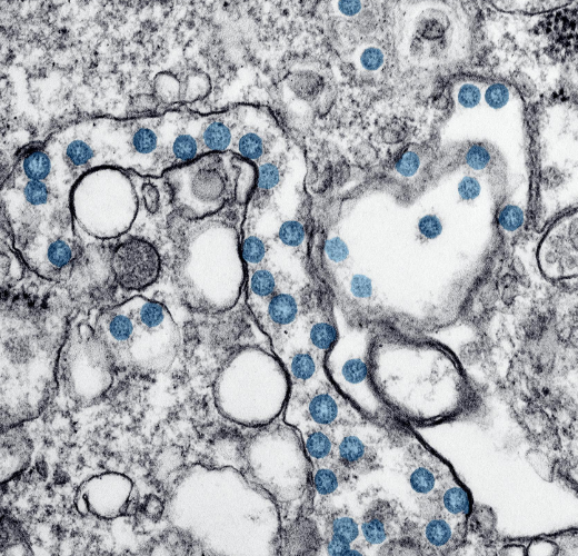 Microbiome et hydratation : Le duo gagnant pour votre santé intestinale